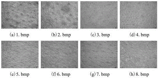 Skin condition quantitative evaluation method based on gray level co-occurrence matrix