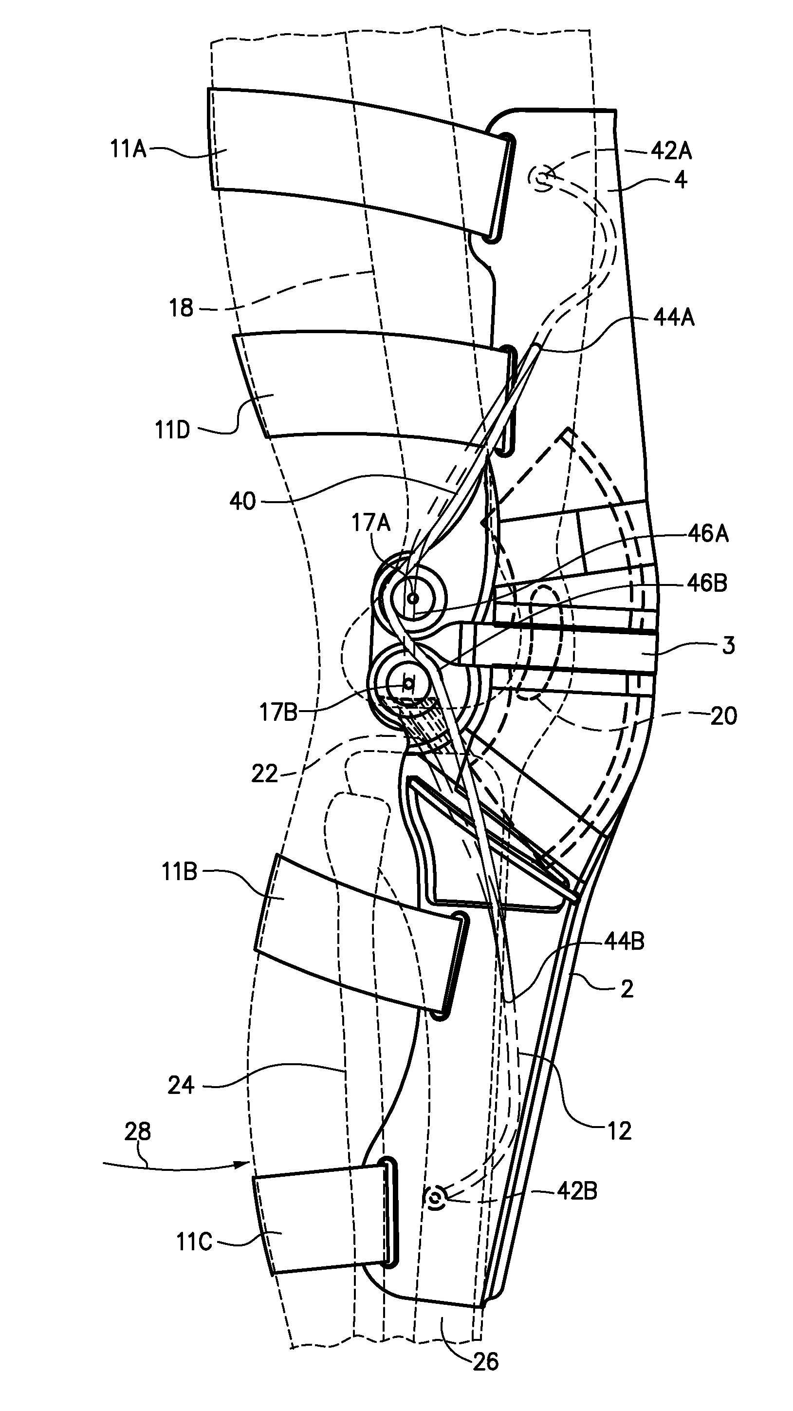 Cable Knee Brace System