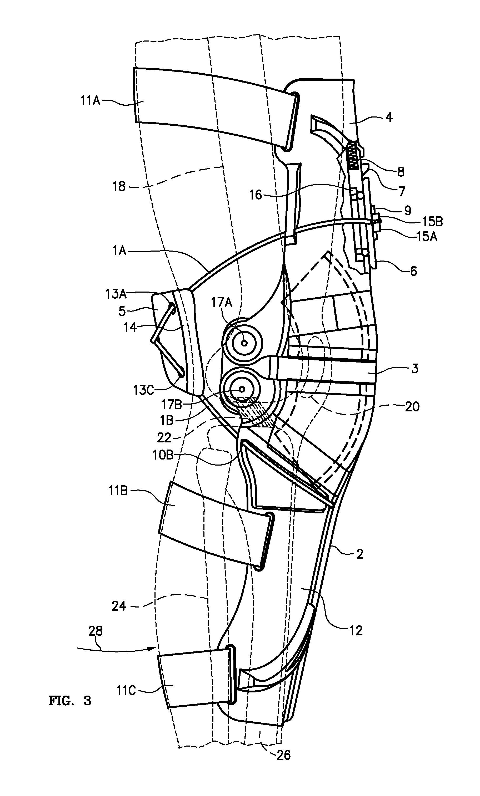 Cable Knee Brace System