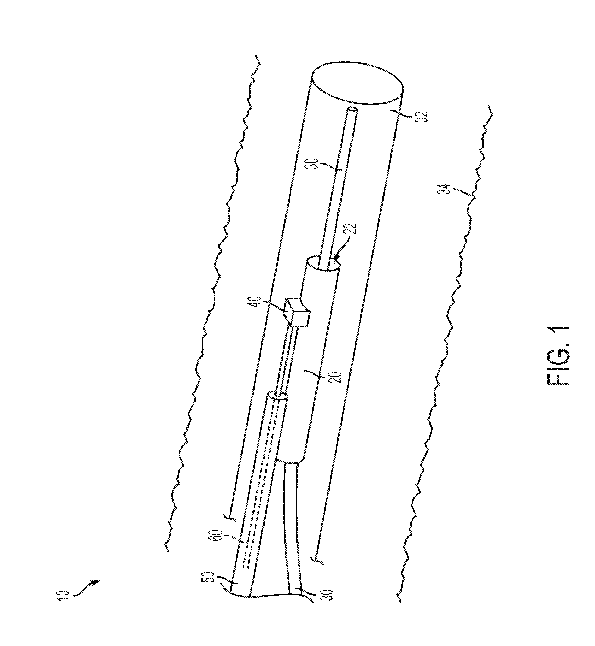 Physiological sensor delivery device and method