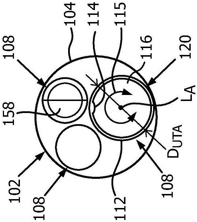 System for performing extraluminal coronary bypass and method of operation thereof