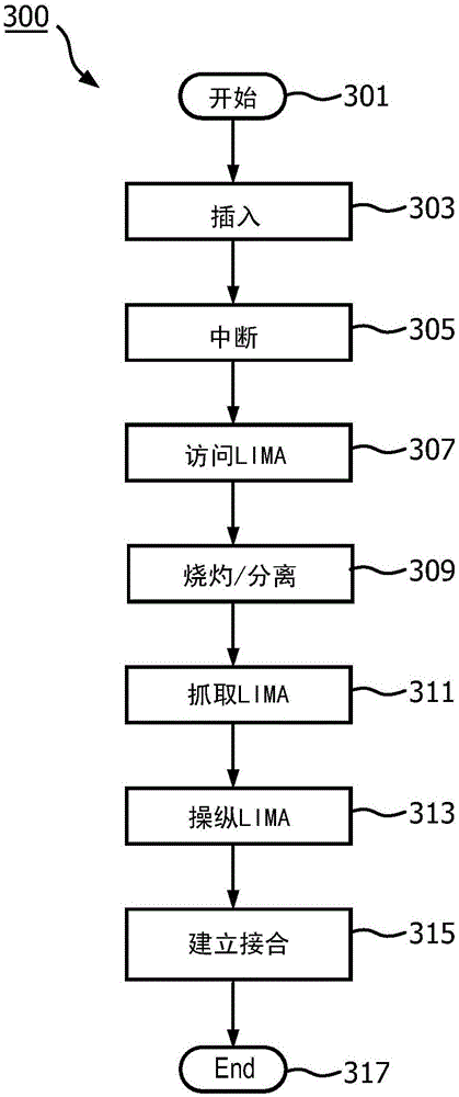 System for performing extraluminal coronary bypass and method of operation thereof