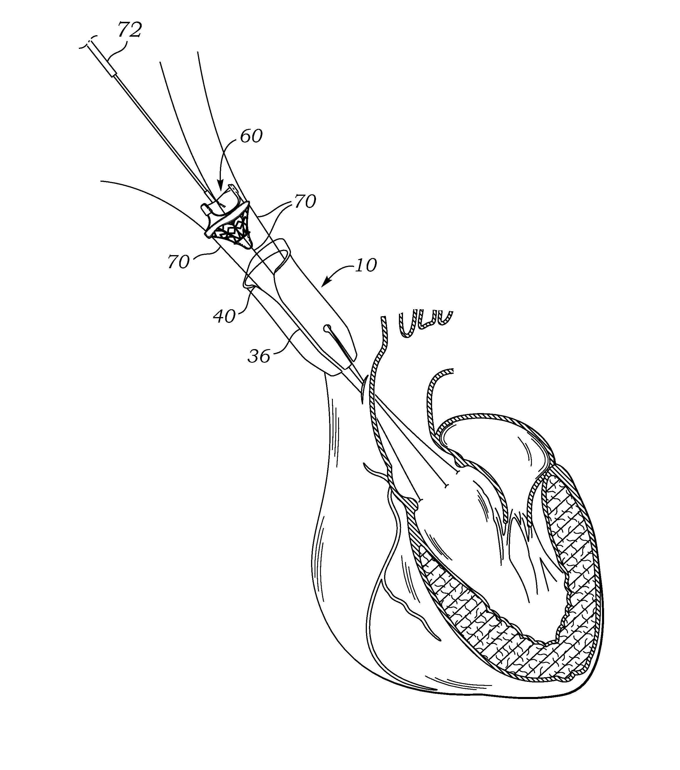 Introducer for prosthetic heart valve