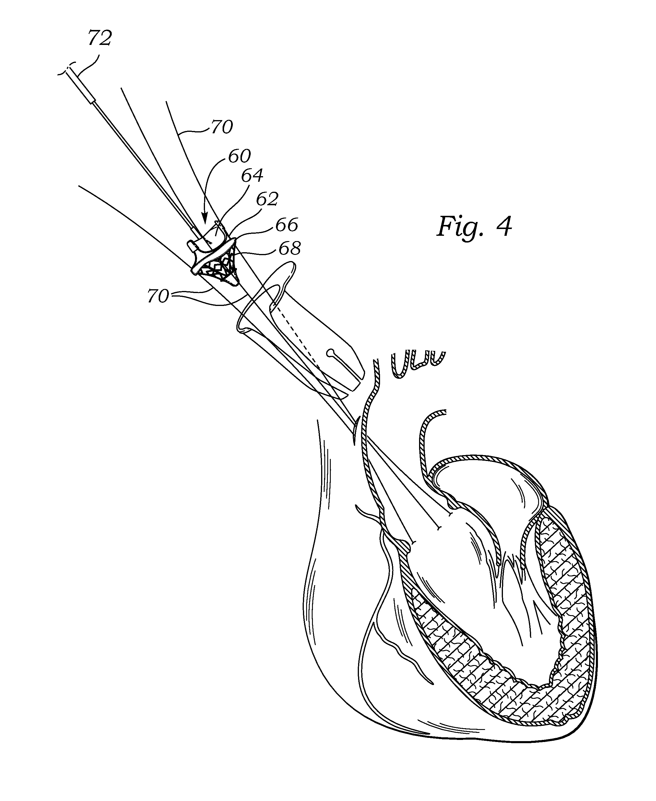 Introducer for prosthetic heart valve