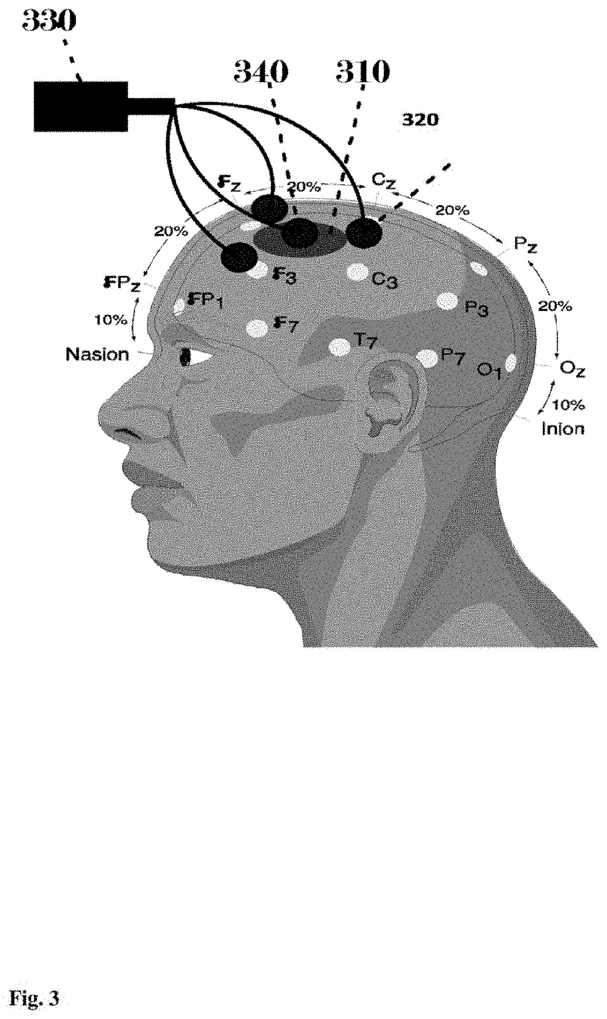 Method and system for suicide risk assessment and intervention