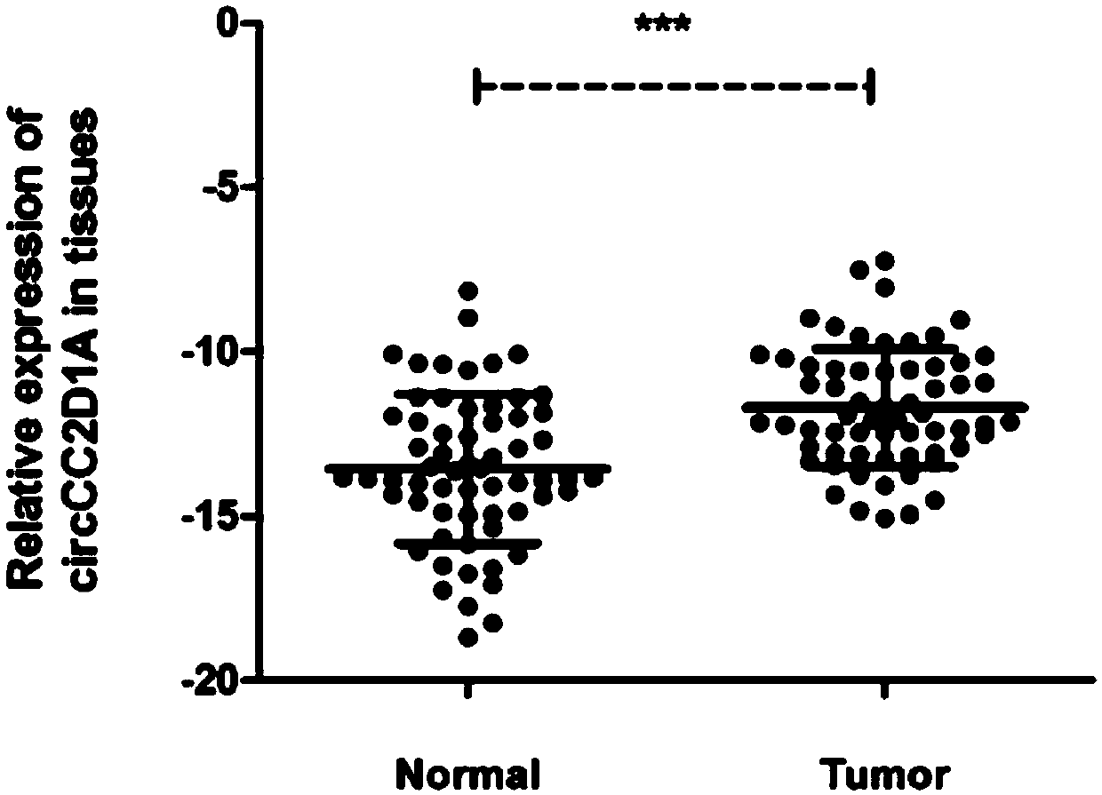 Application of novel gastric cancer marker gene circPTPDC1