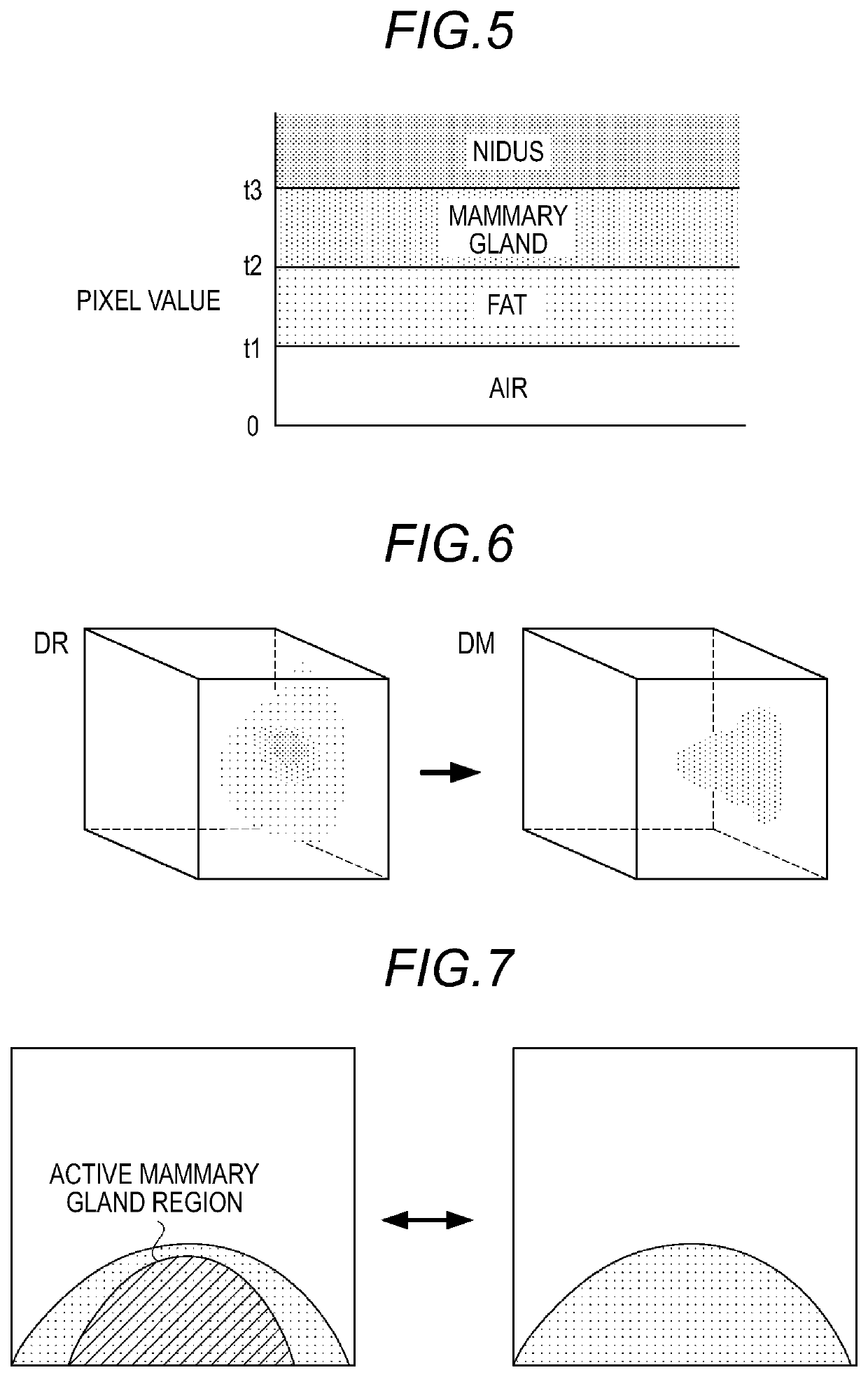 Image capturing apparatus for breast examination