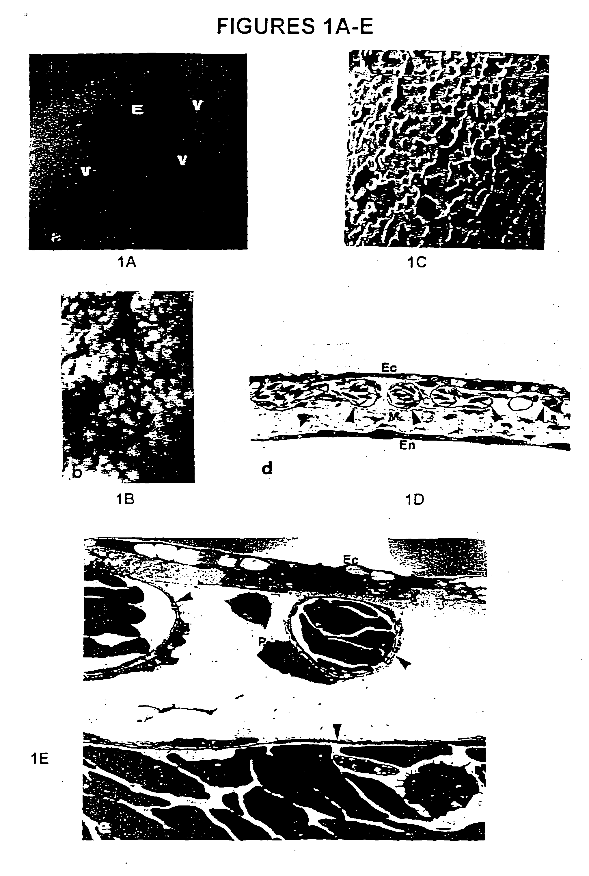 Anti-angiogenic compositions and methods of use