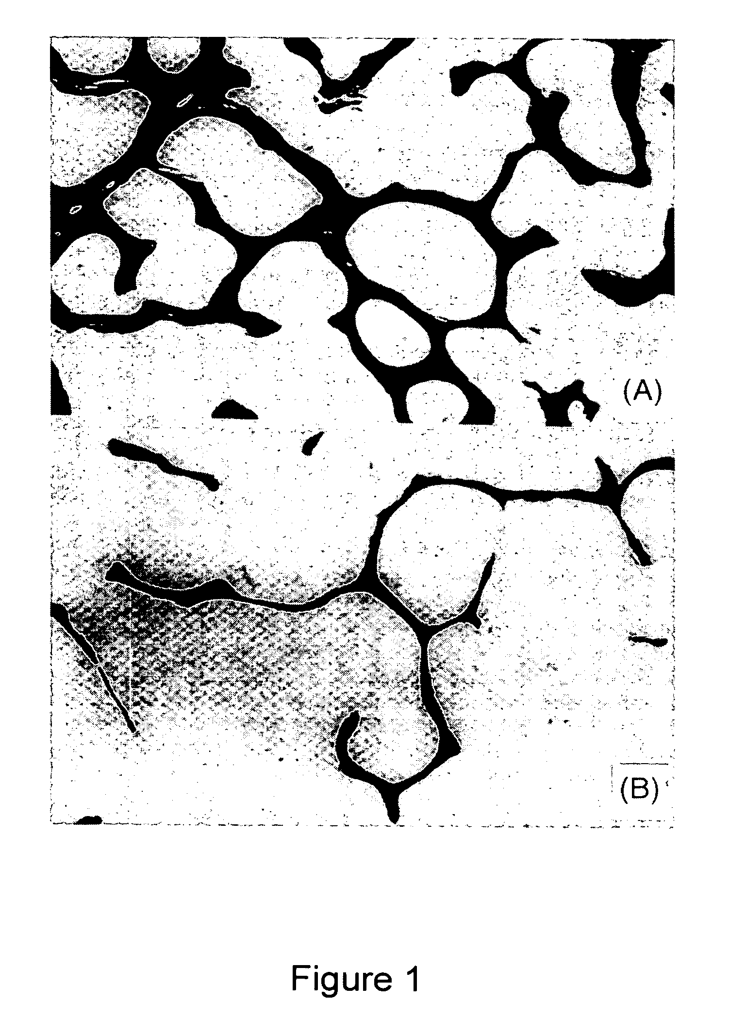 Porous calcium phosphate networks for synthetic bone material