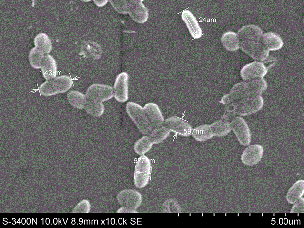 Enterobacter cloacae and application thereof