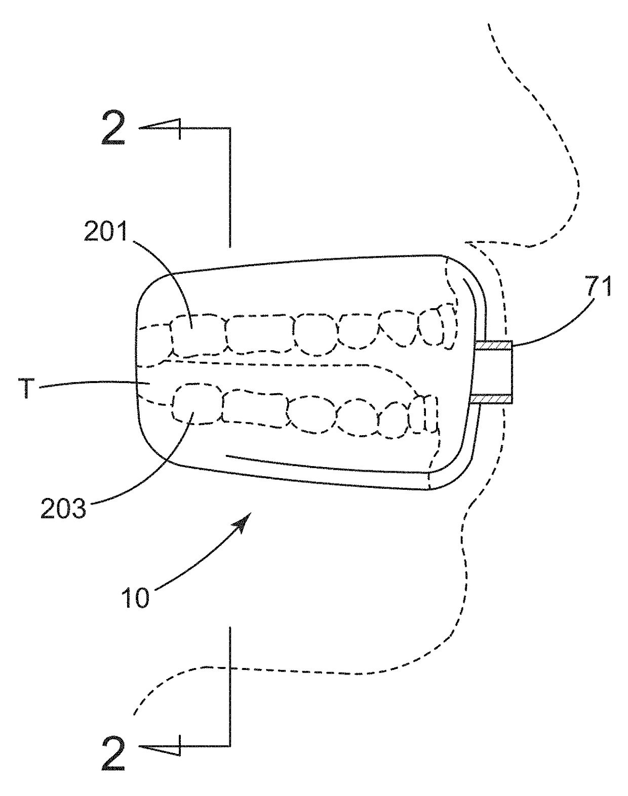 Mouth piece for cooling of oral tissue of a patient during chemotherapy treatment