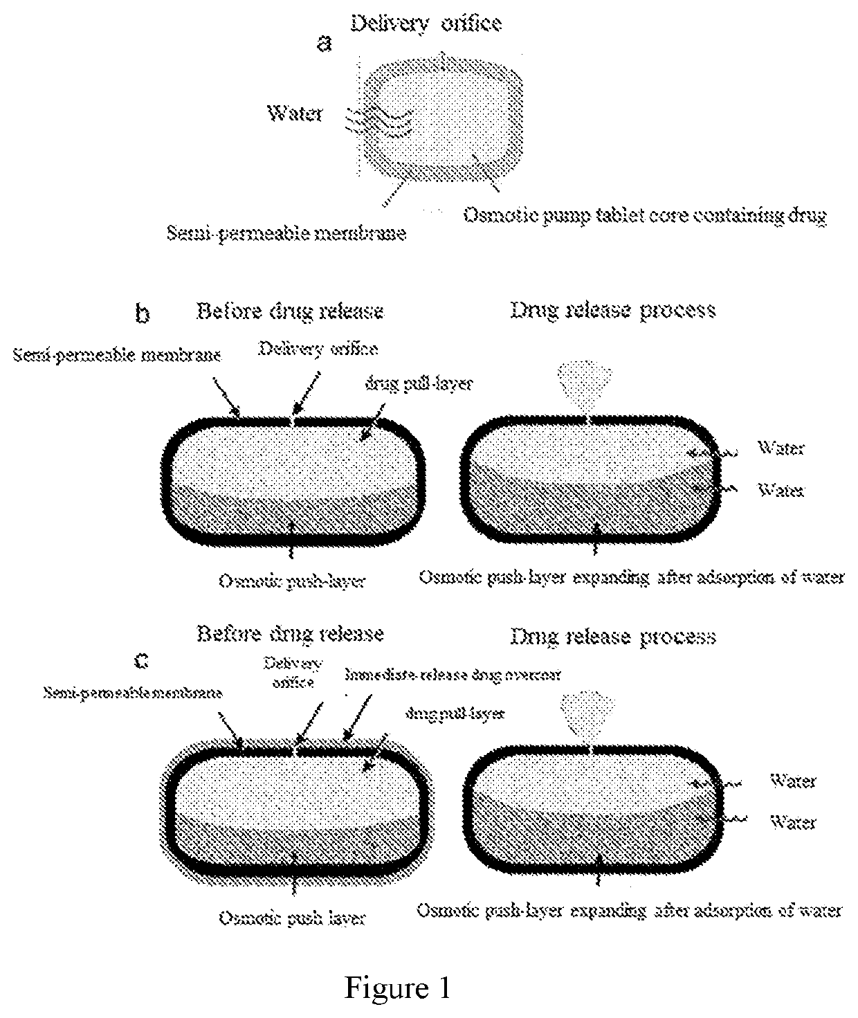 Pharmaceutical composition and preparation method therefor and use thereof