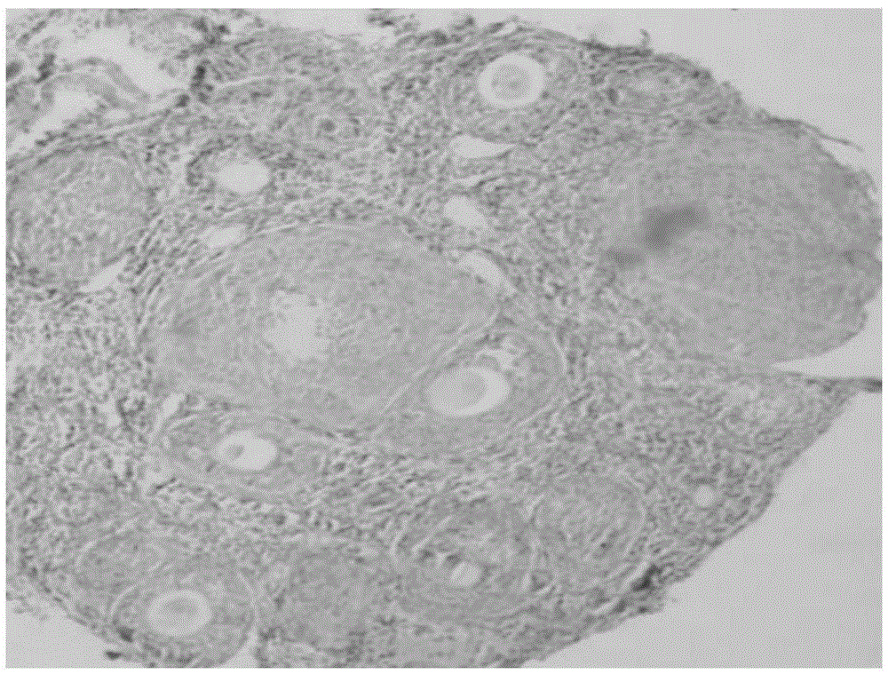 Preparation method of a kind of animal model of phlegm and blood stasis mixed ovarian cyst