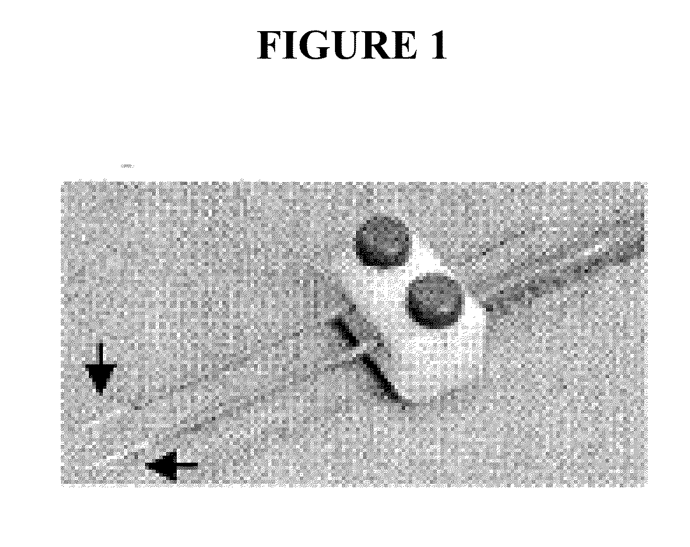 Devices for material delivery, electroporation, and monitoring electrophysiological activity