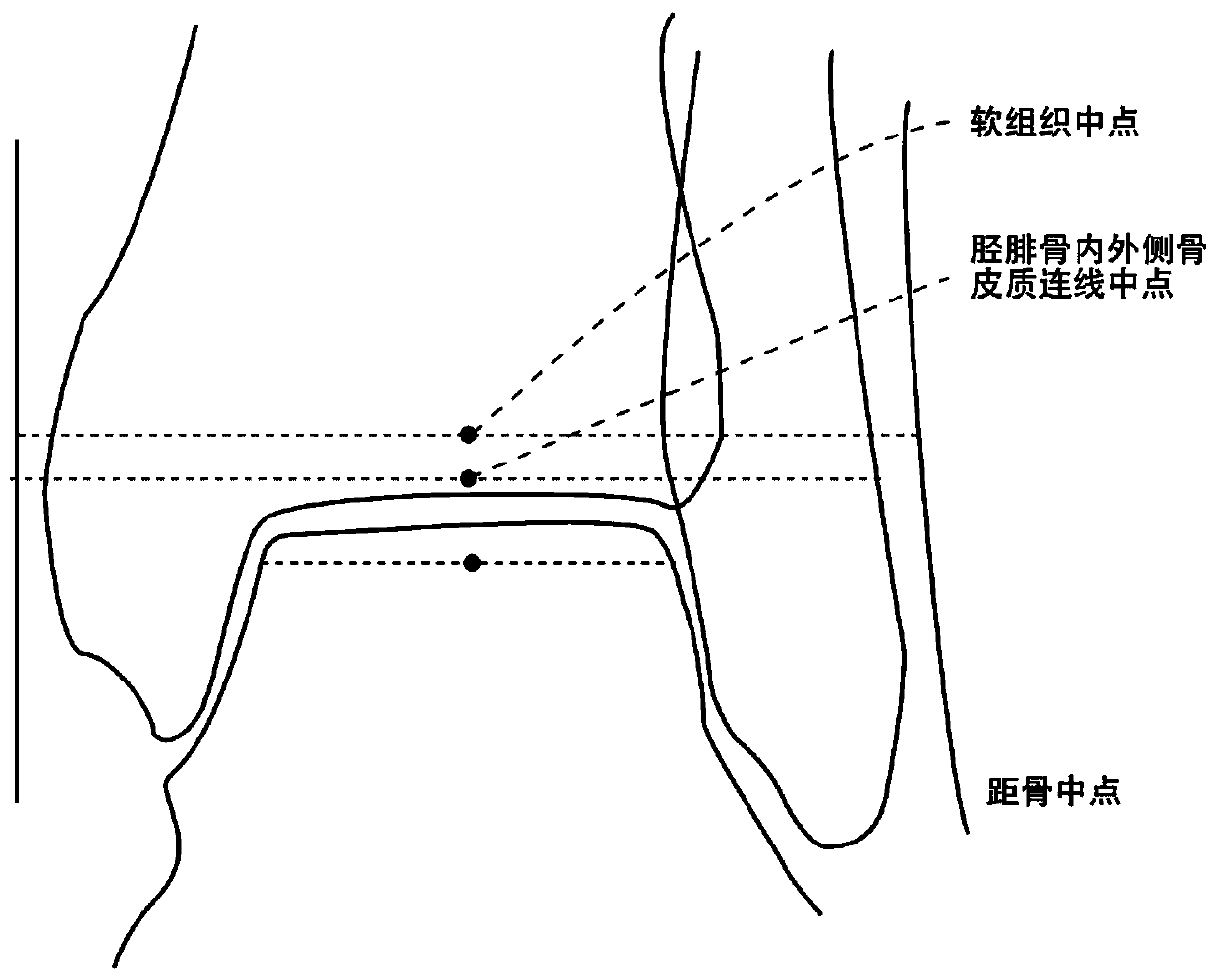 Leg-bone lower limb force line automatic detection method and device