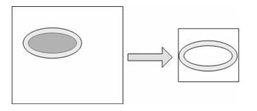 Image-based method for identifying shape of parasite egg