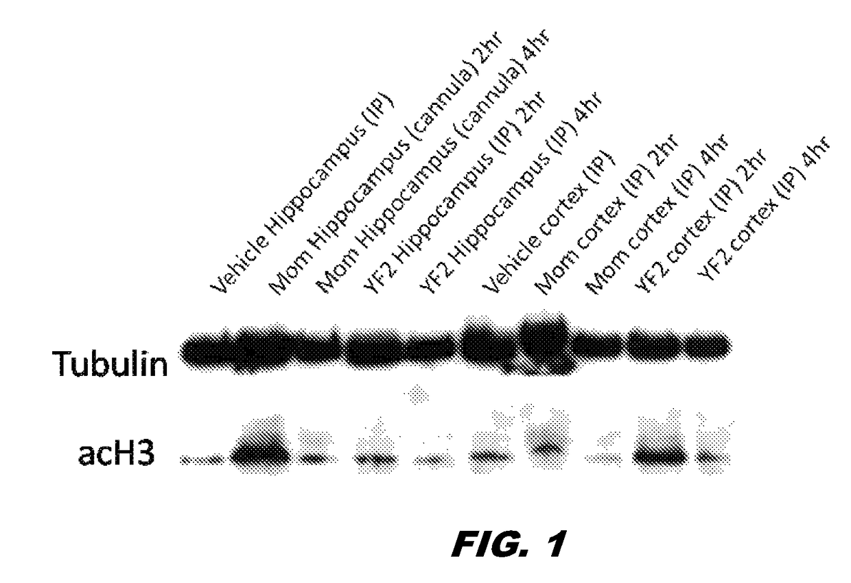 Uses of histone acetyltransferase activators