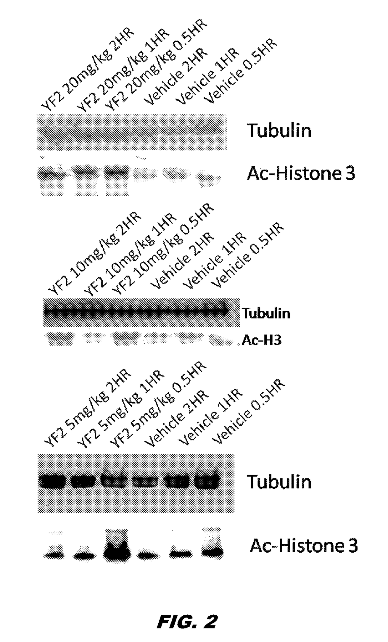 Uses of histone acetyltransferase activators