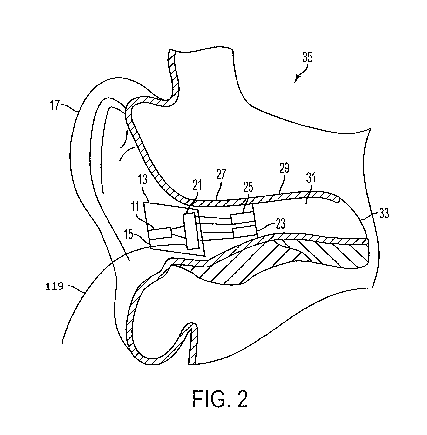 Earhealth monitoring system and method II