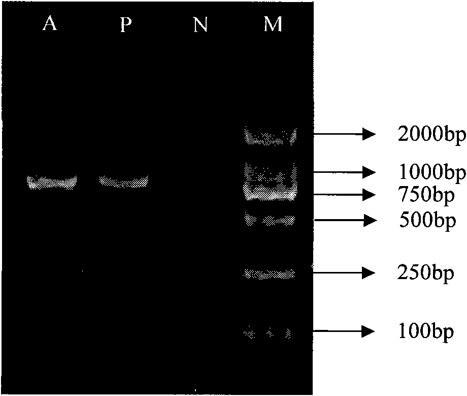 Nucleotide specific to wzt of Legionella pneumophila serogroup 1 and application thereof