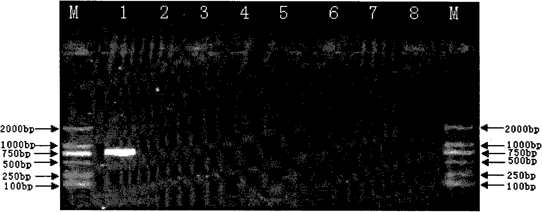 Nucleotide specific to wzt of Legionella pneumophila serogroup 1 and application thereof