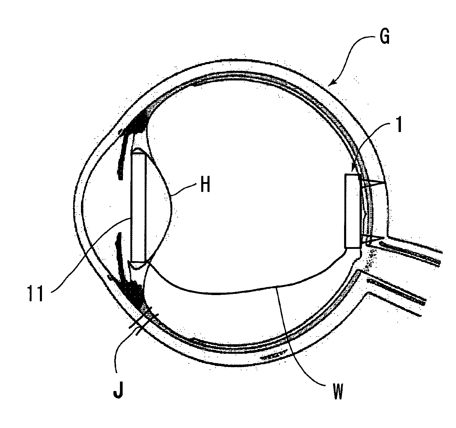 Electrode member for retinal stimulation, and artificial retinal device using the electrode member