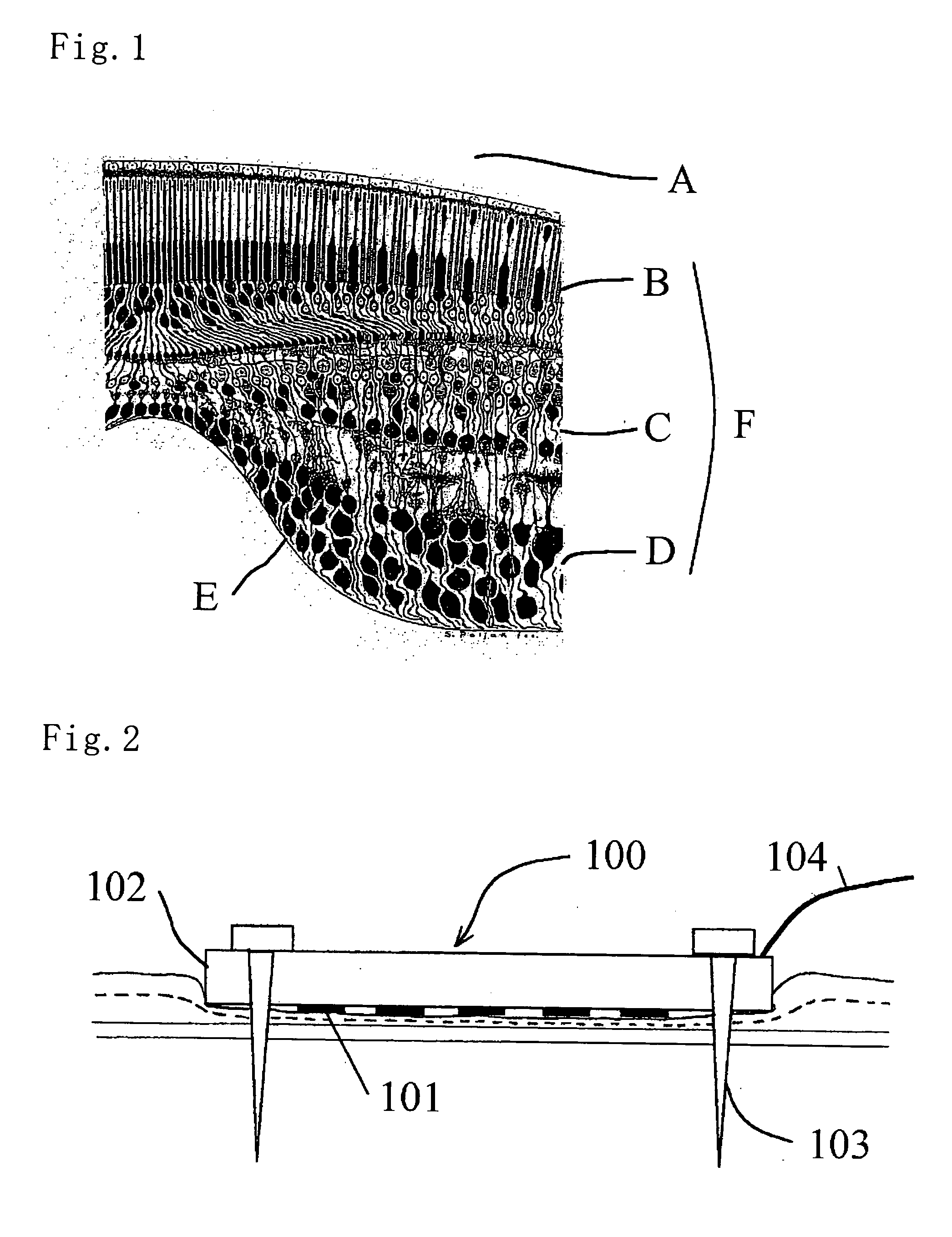 Electrode member for retinal stimulation, and artificial retinal device using the electrode member