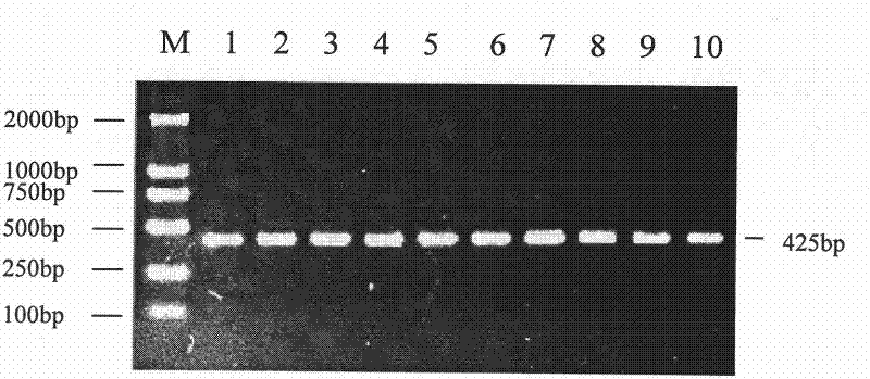 Single nucleotide polymorphism of GHRHR genes in dairy goat and detection method thereof