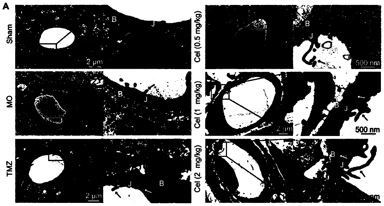 Application of celastrol in inhibiting tumor vasculogenic mimicry