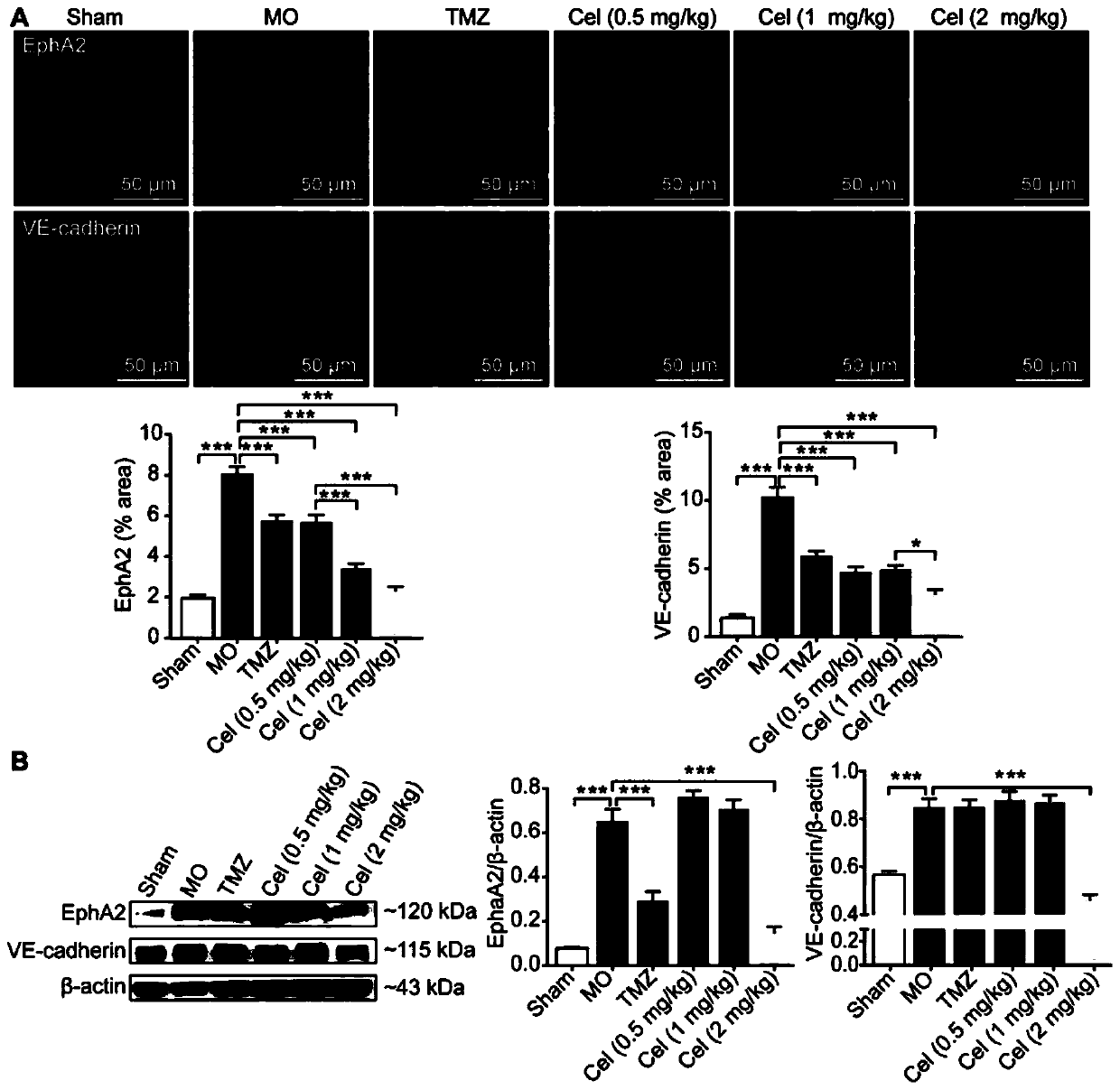 Application of celastrol in inhibiting tumor vasculogenic mimicry