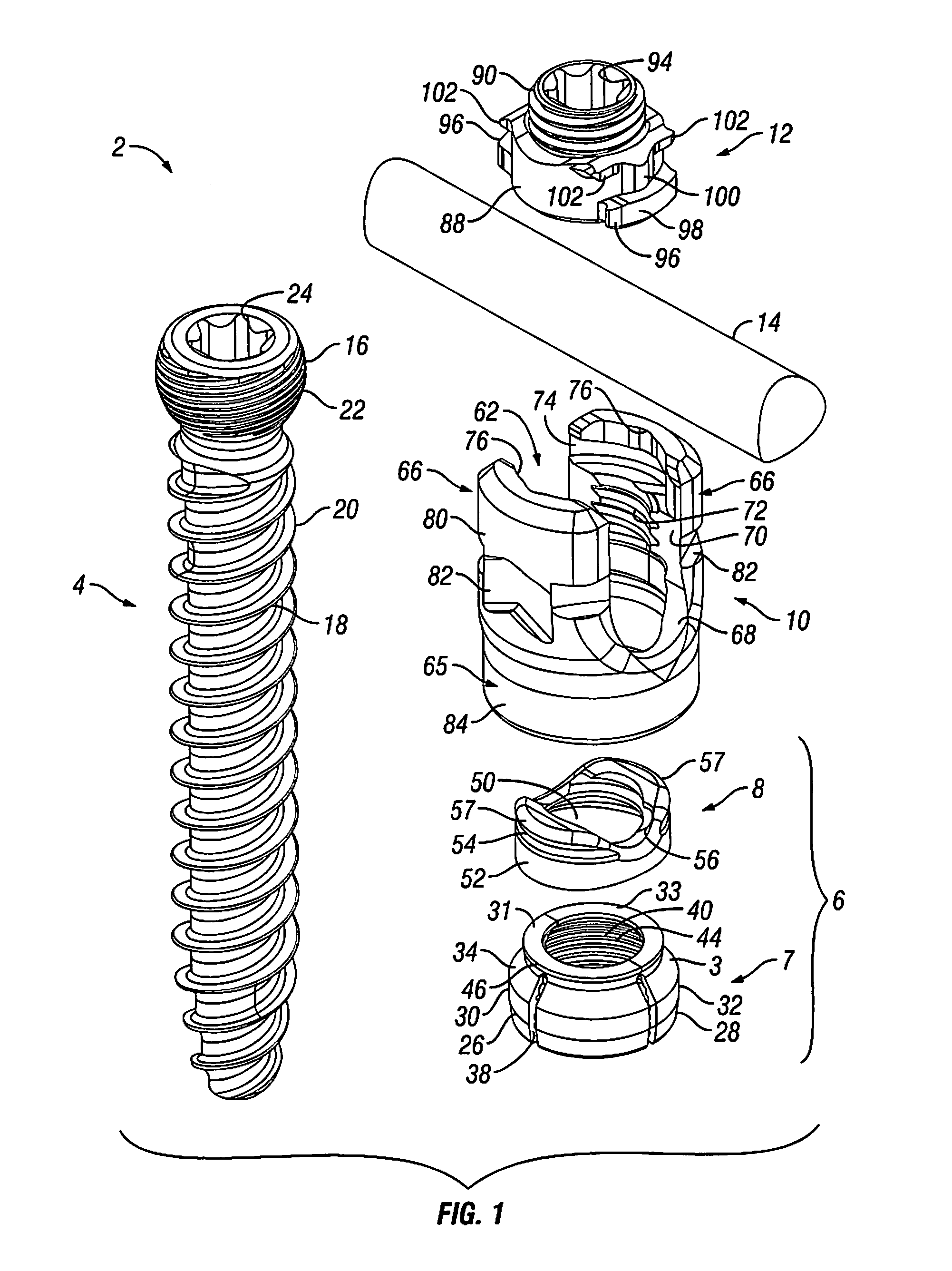 Orthopedic fixation devices and methods of installation thereof