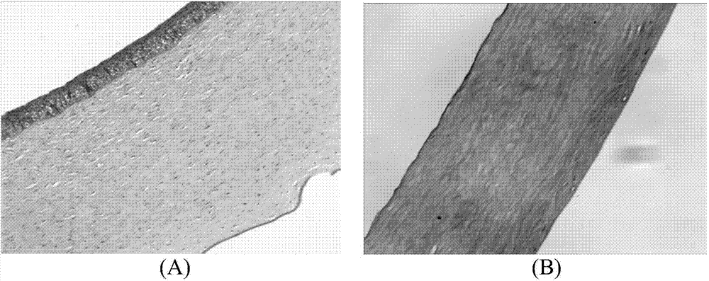 Acellular corneal stroma and preparing method for acellular corneal stroma