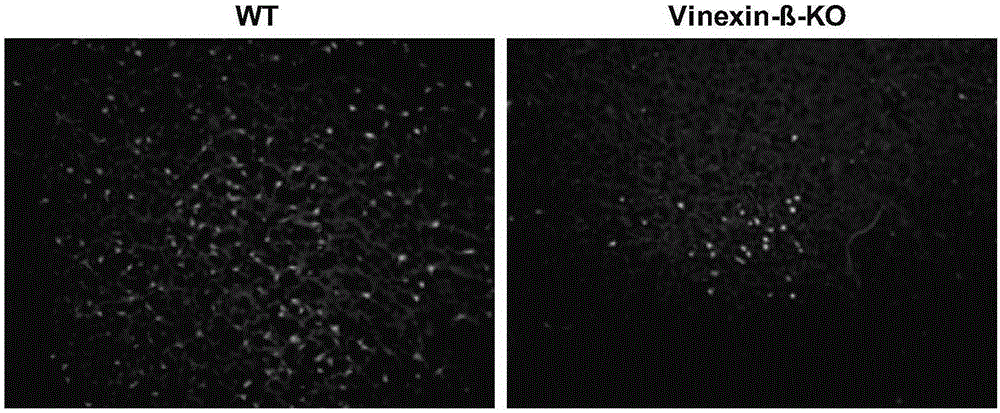 Application of vinexin-β in the treatment of stroke