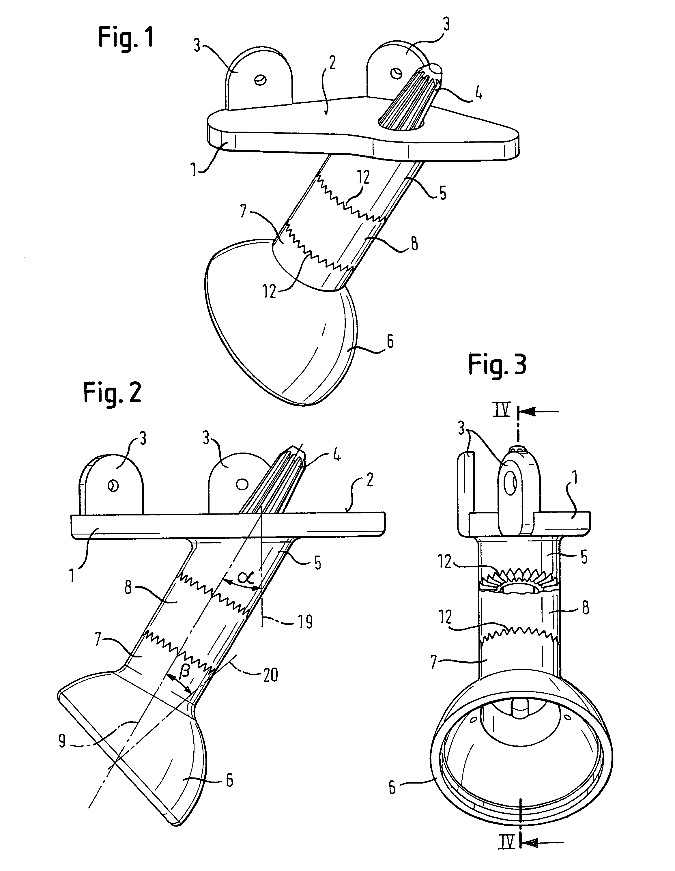 Endoprosthesis for part of the pelvis