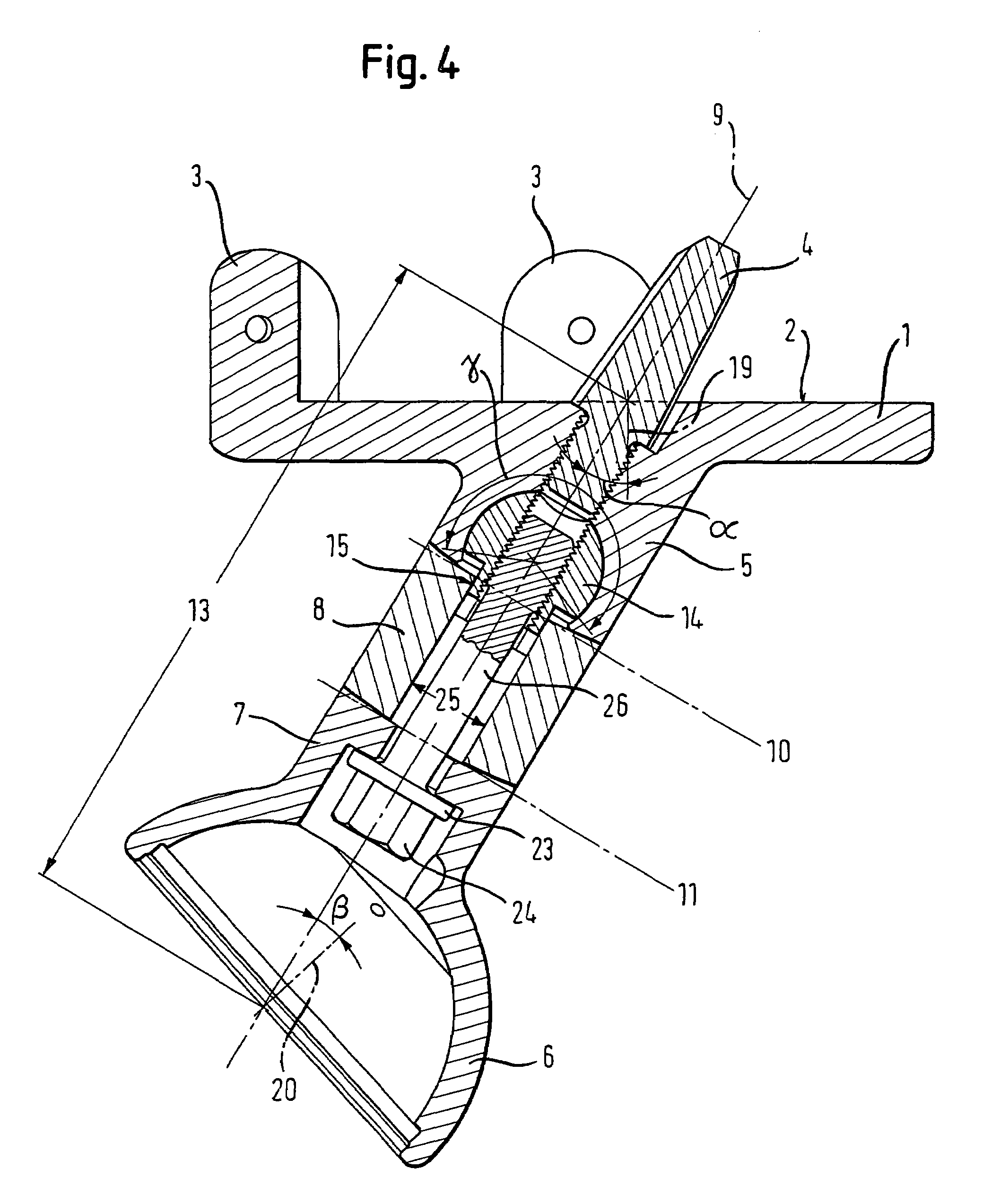 Endoprosthesis for part of the pelvis