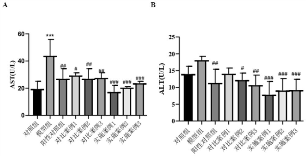 Preparation method of radix puerariae compound fermented beverage with effects of dispelling effects of alcohol and protecting liver