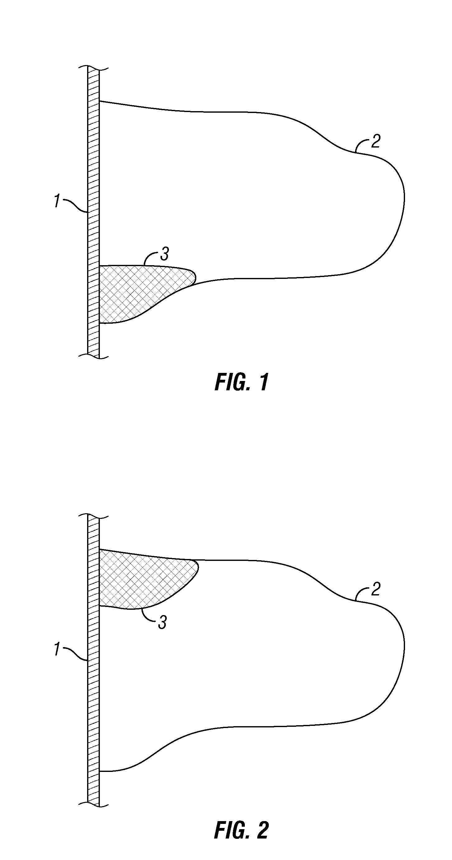 Hydraulic fracture height growth control