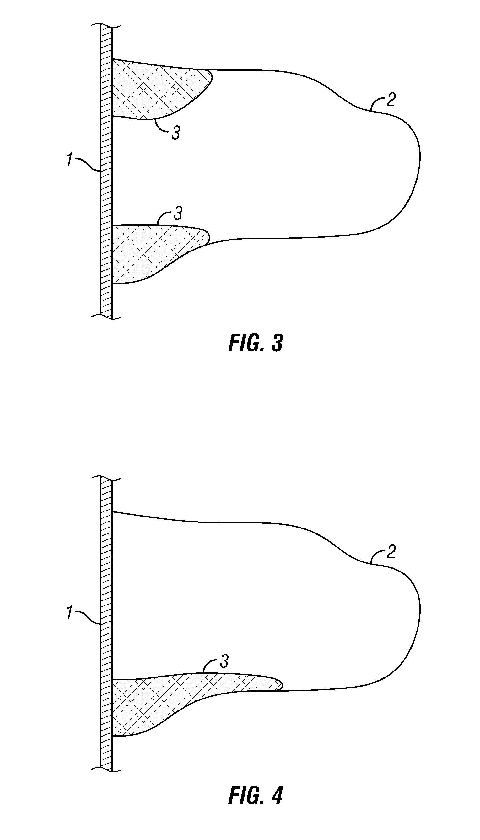 Hydraulic fracture height growth control