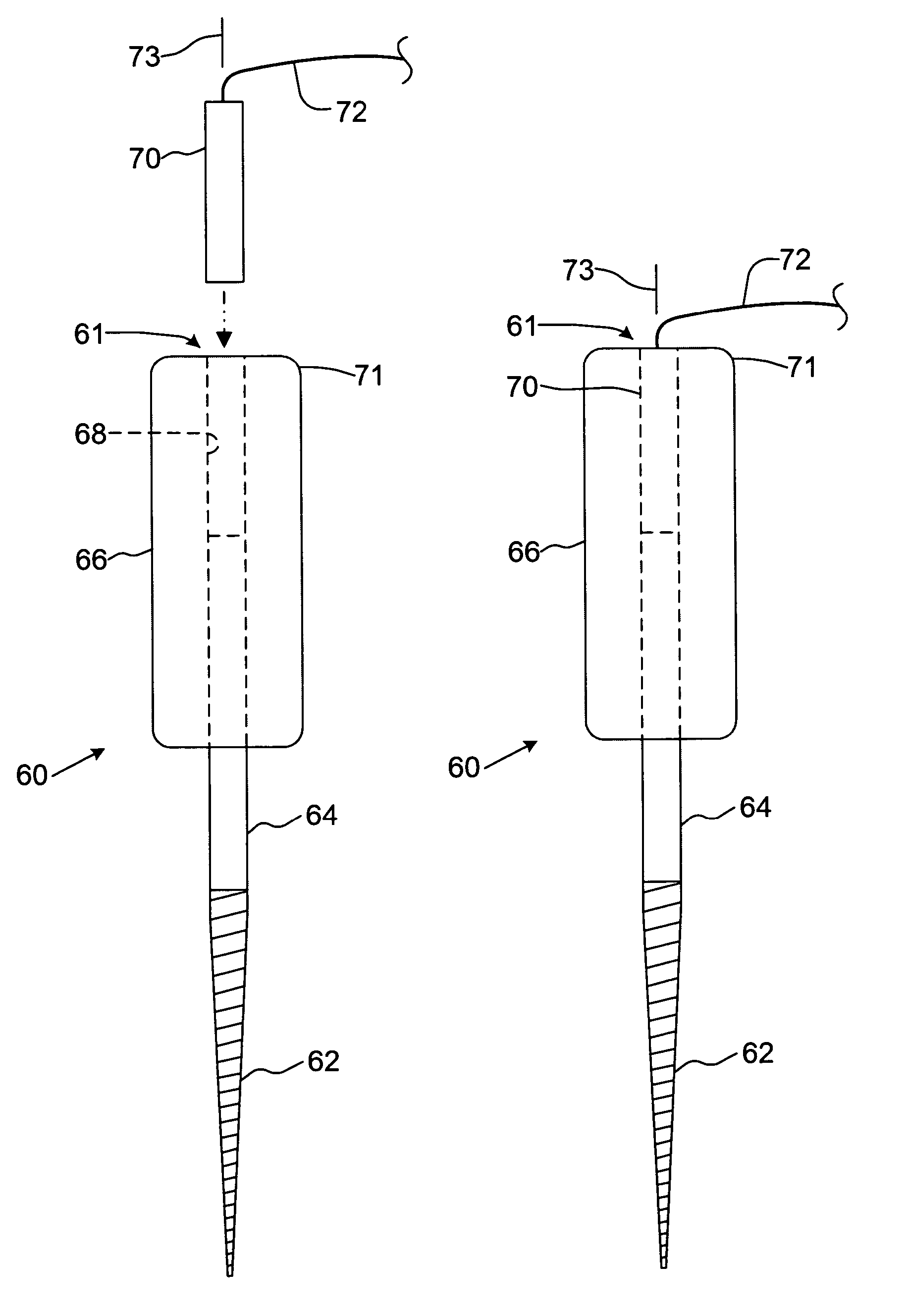 Endodontic instrument