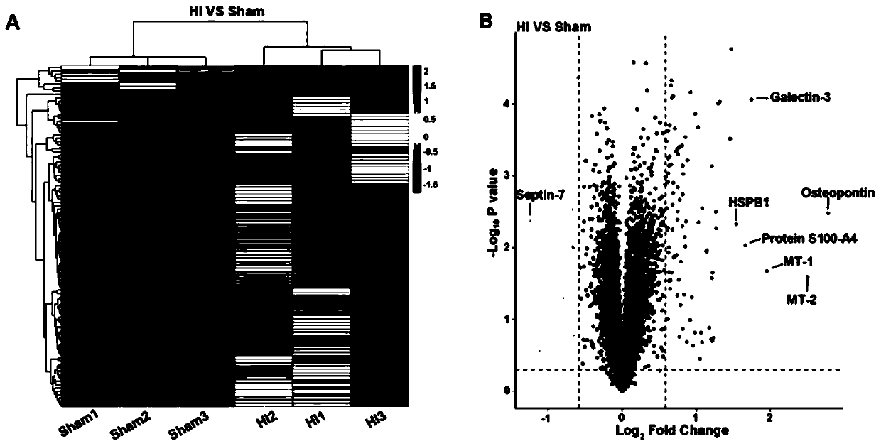 Application of osteopontin to hypoxic ischemic brain damage