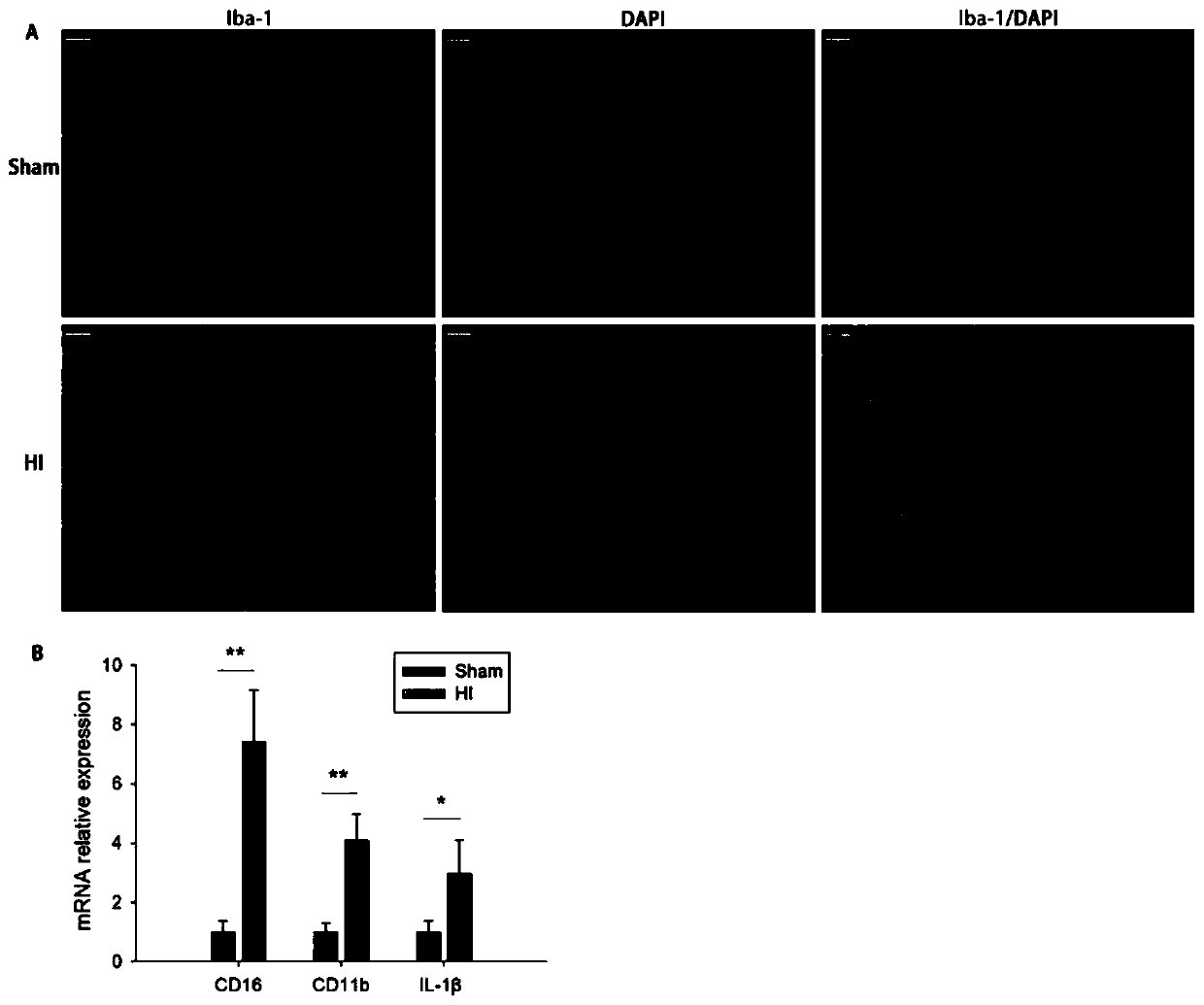 Application of osteopontin to hypoxic ischemic brain damage