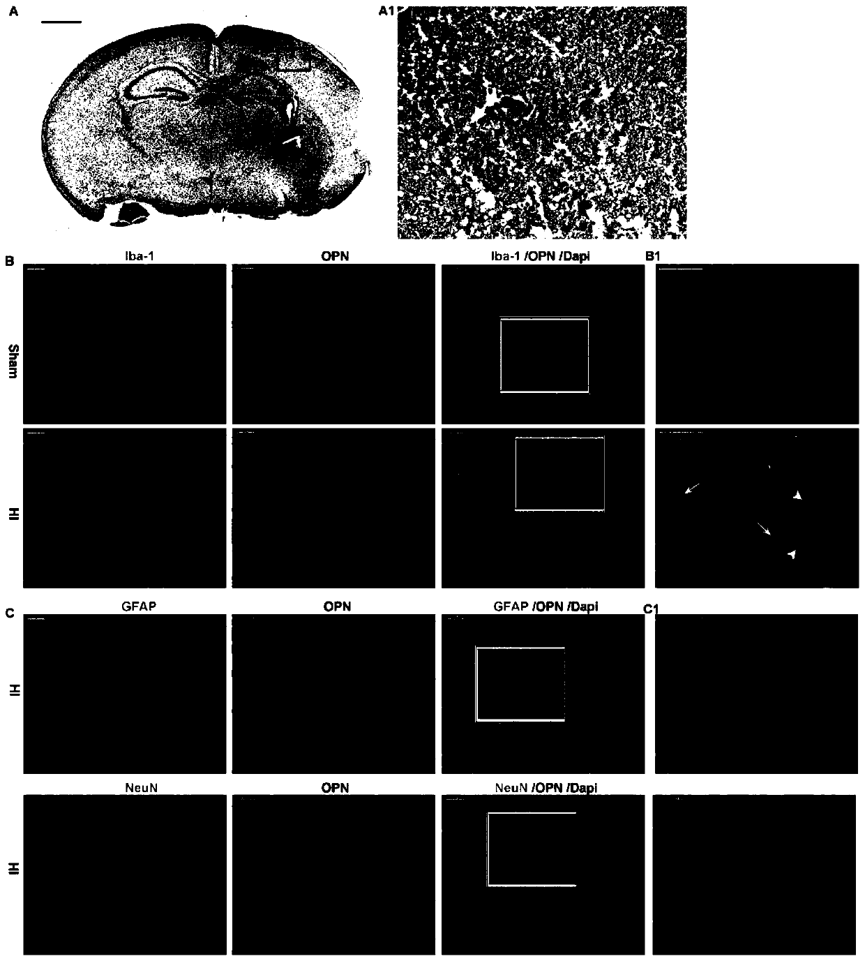 Application of osteopontin to hypoxic ischemic brain damage