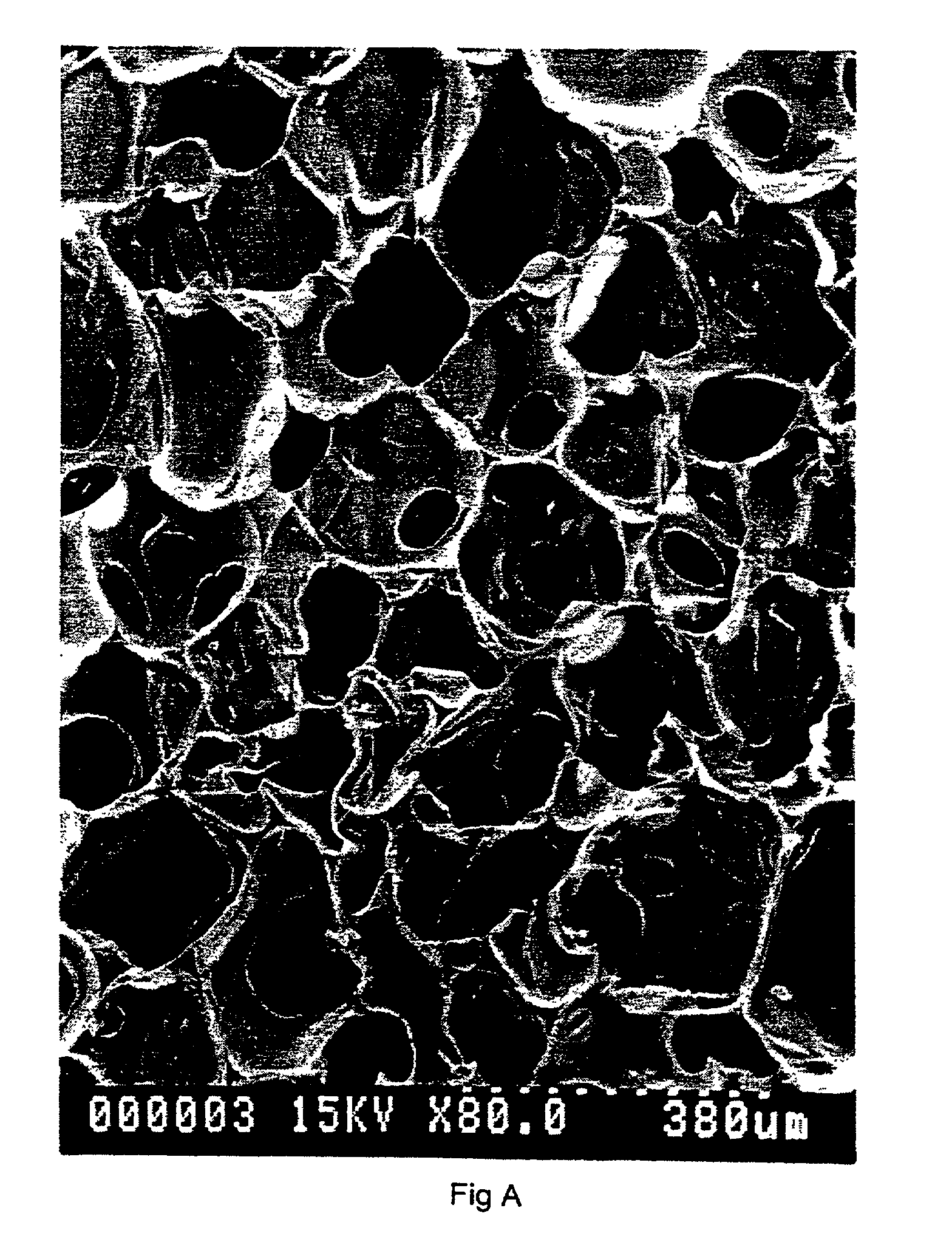 Tissue engineering scaffold