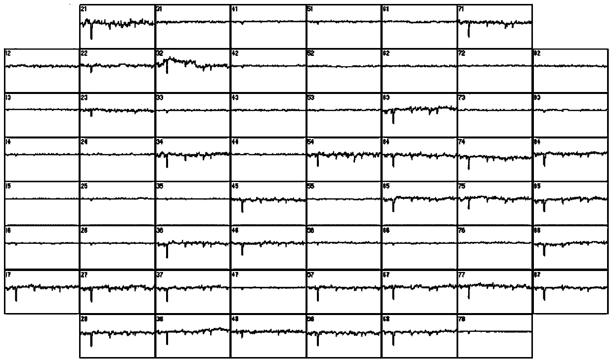 Synchronous monitoring method for chemical signals and electric signals of neural cell network