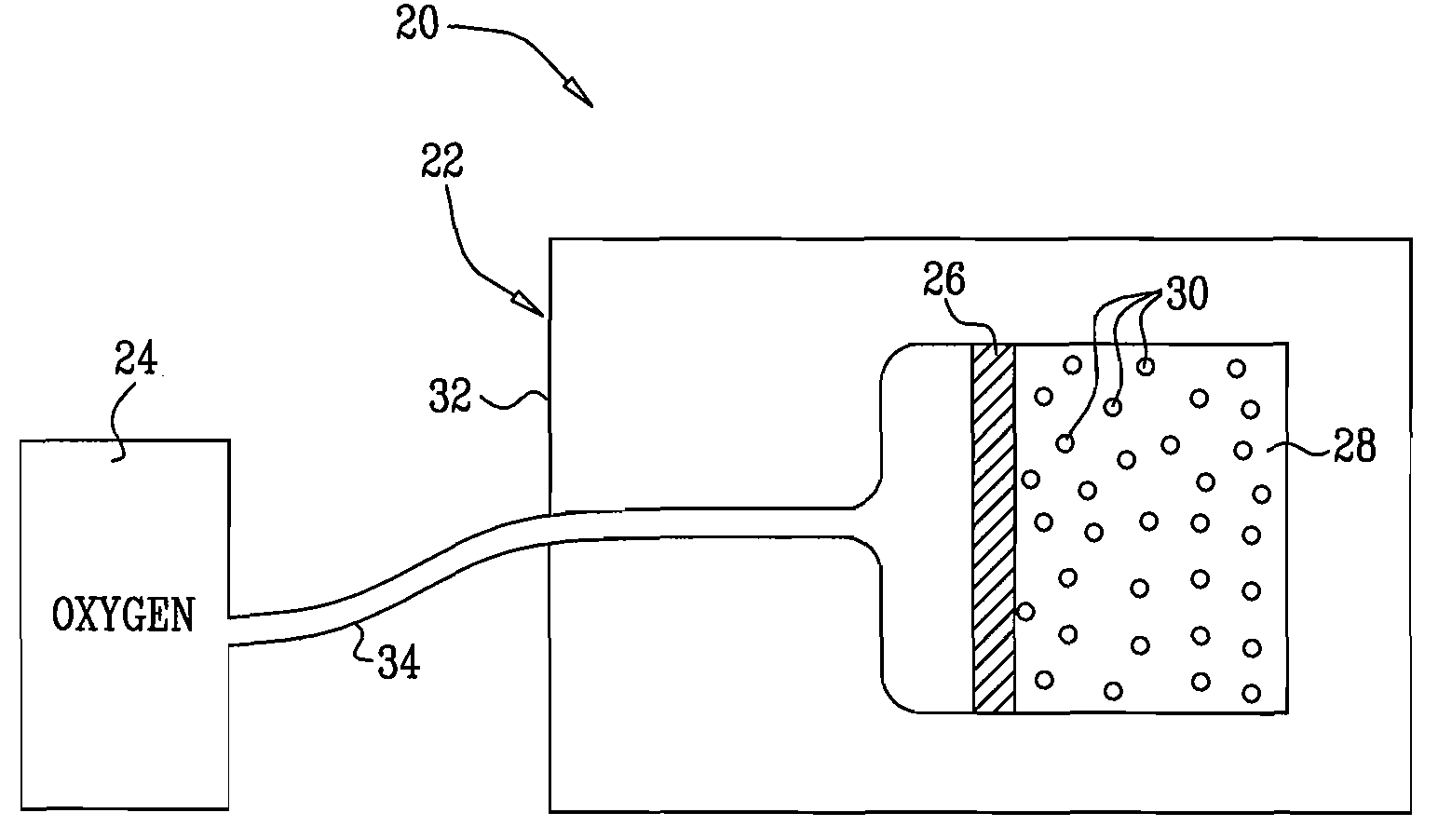 Oxygen supply for cell transplant and vascularization