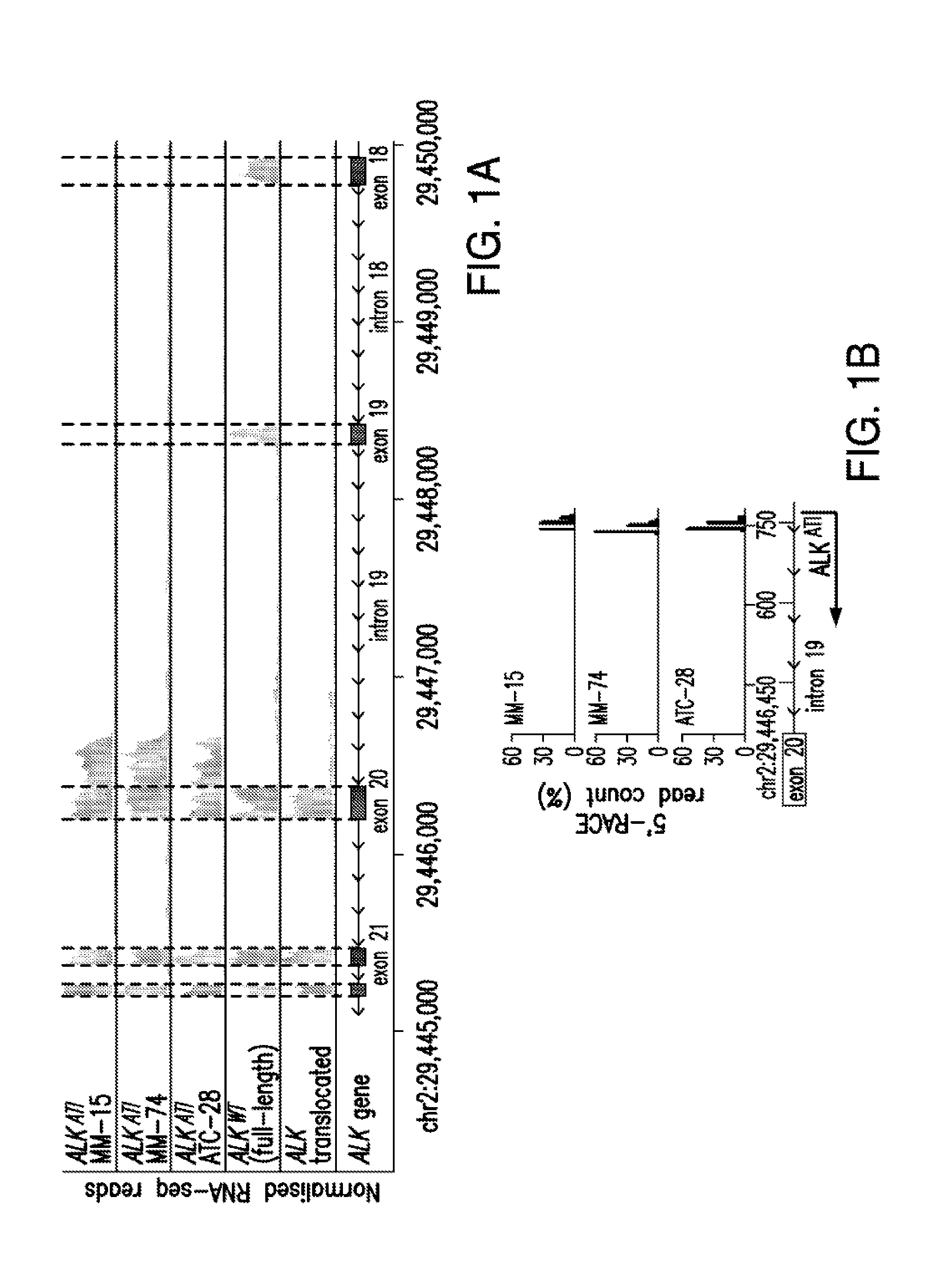 Novel isoform of anaplastic lymphoma kinase and its uses