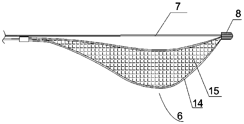 Gallstone removal device