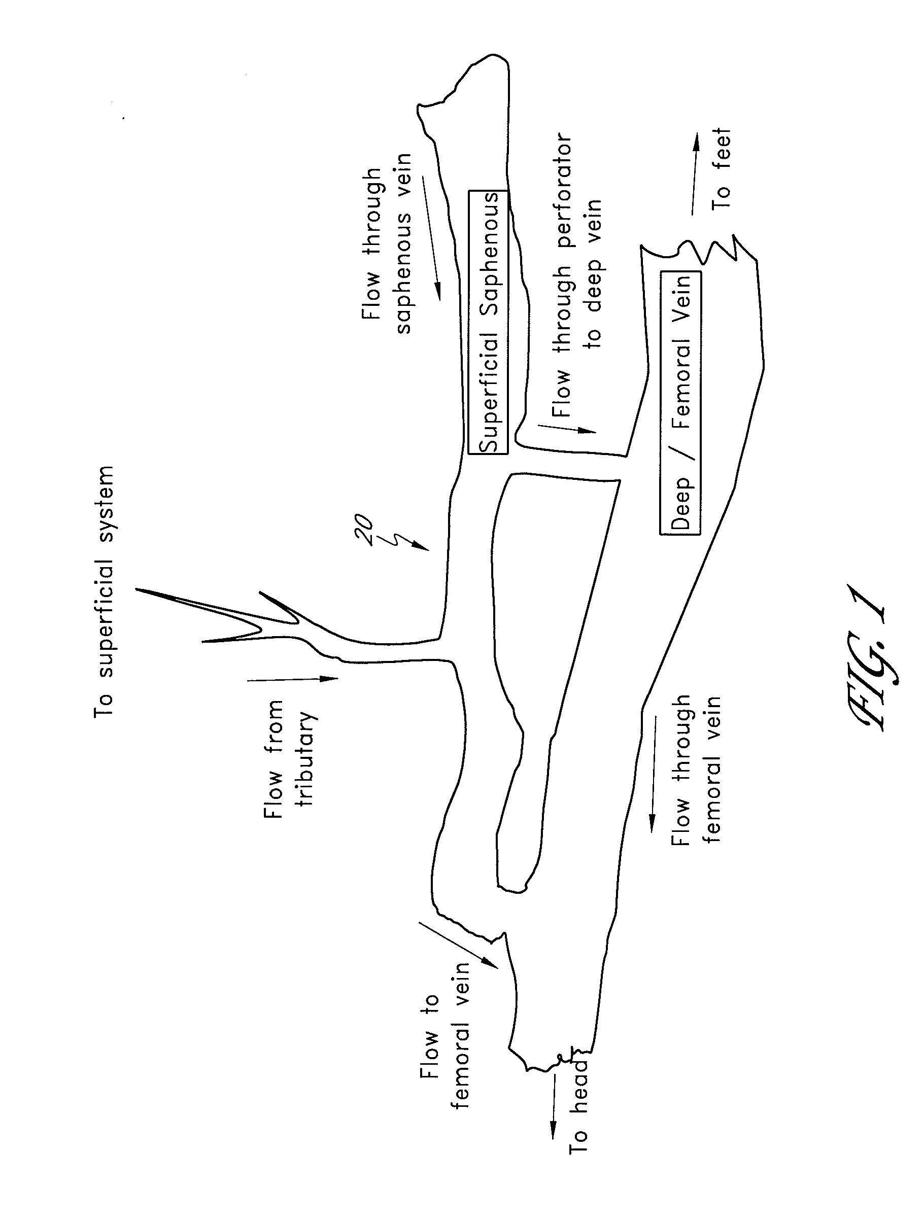 Structures for permanent occlusion of a hollow anatomical structure