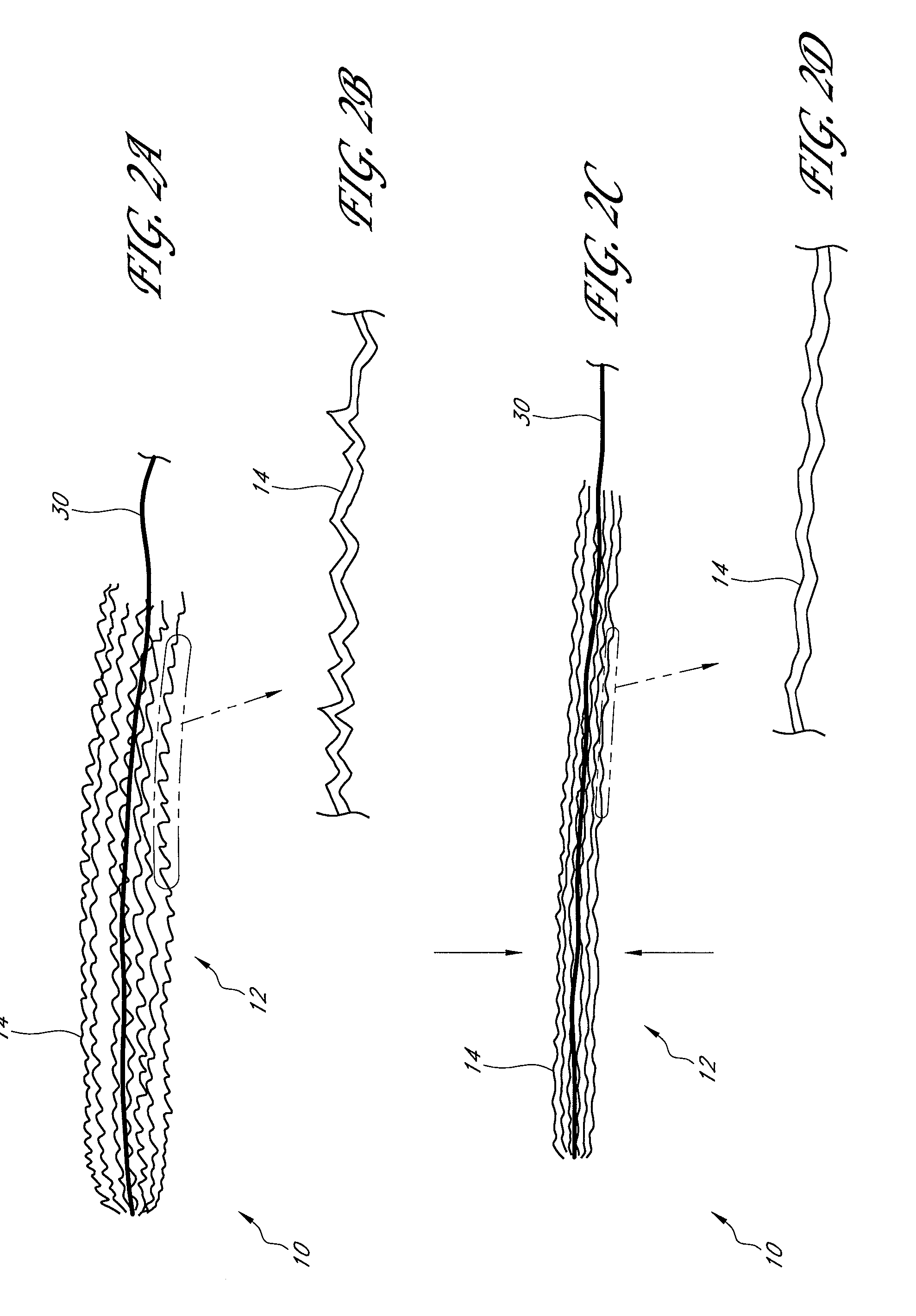 Structures for permanent occlusion of a hollow anatomical structure