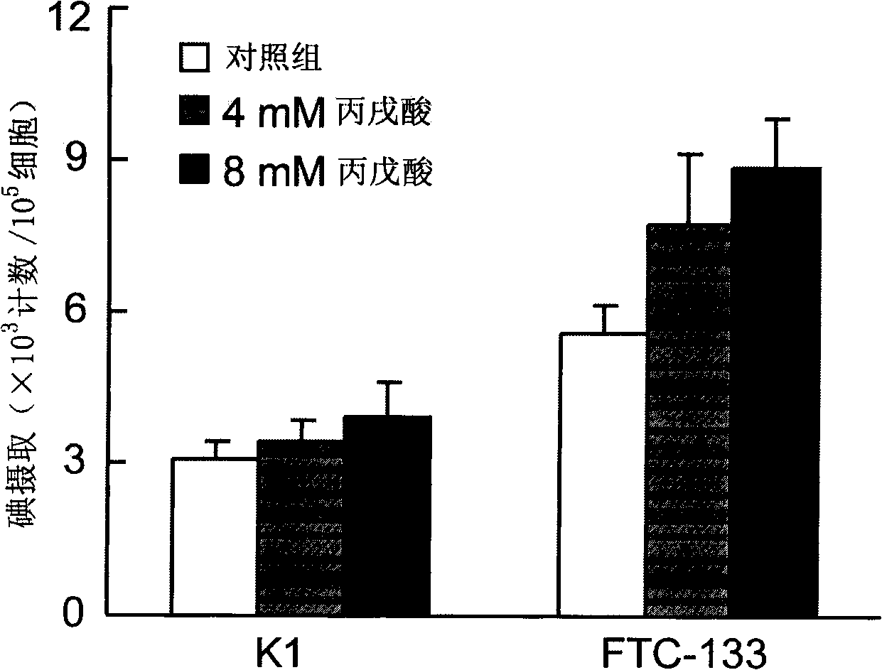 Application of valproate and salt-induced redifferentiation combined with &lt;131&gt; iodine thereof in treating poor differentiation/dedifferentiation thyroid cancer